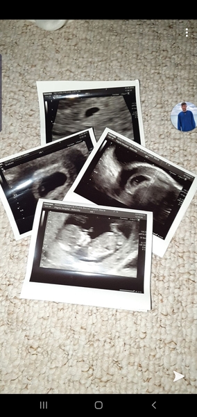 Due June 2020: Thread 2