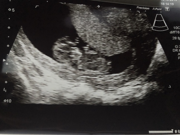 Babies Due May 2020 thread 2