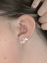 For those with experience of piercings - Does this look normal