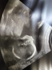 Boy or girl
