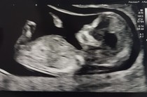 Gender 13 weeks. Numb Theory