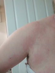About this random middle of the night rash?!