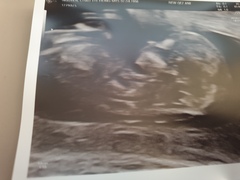 Due May 2020 (thread 3)