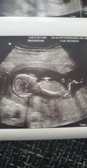 Do you think boy or girl