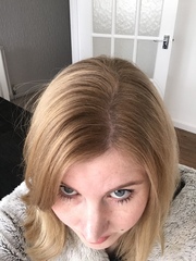 Freaking out over this hairloss!!!