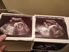 Boy or girl