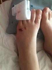 DS 11 can’t weight near after fall - A&E or wait and see?