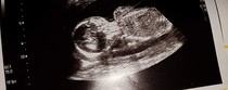 Gender 13 weeks. Numb Theory