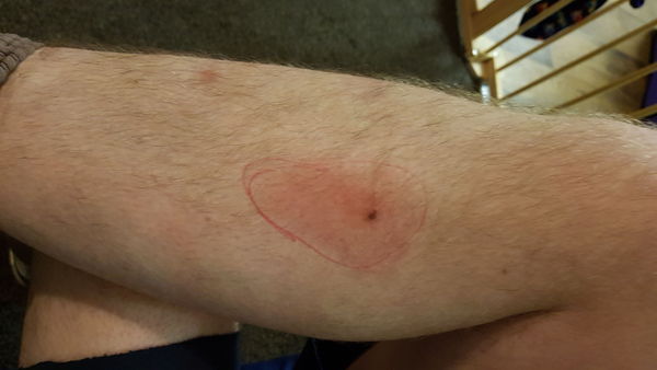 Worried about this bite