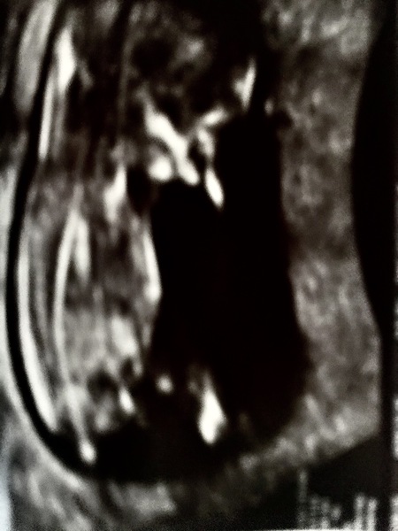Due May 2020 (Thread 4)