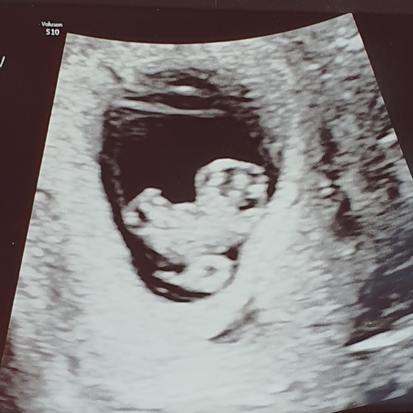 The Graduates of TTC after pregnancy loss thread#5 - 🐧 The Penguin Huddle 🐧