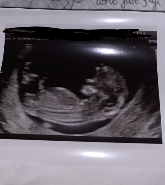 A boy?..or a girl?