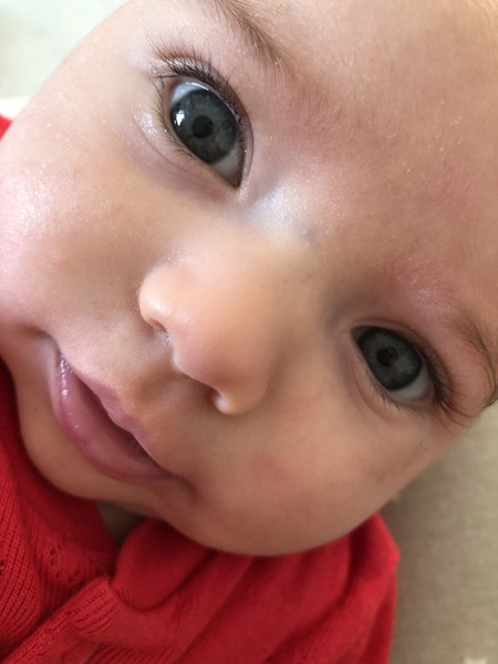 Eye colour