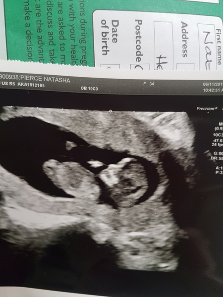 Gender guess from scan