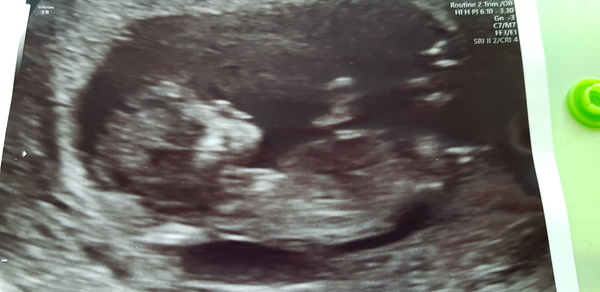 Due May 2020 (thread 3)