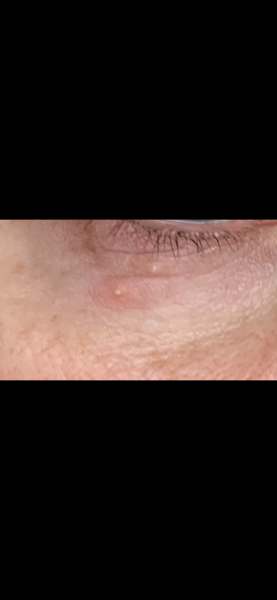 Does anyone know what these spots are?
