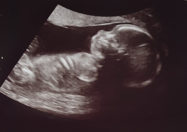 The Graduates of TTC after pregnancy loss thread#5 - 🐧 The Penguin Huddle 🐧