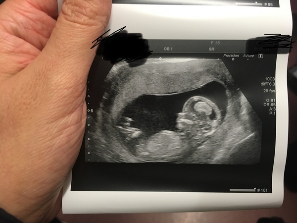 Due May 2020 (thread 3)