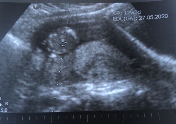 Due May 2020 (thread 3)