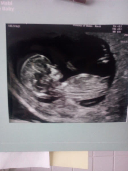 Boy or girl?