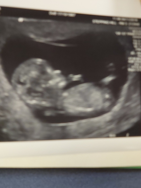 Due May 2020 (thread 3)