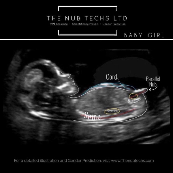 Boy or girl?