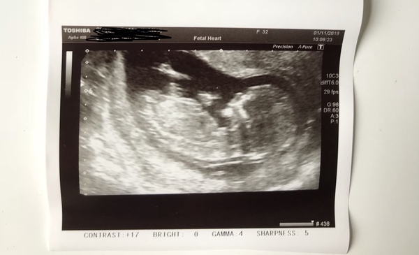 Due May 2020 (thread 3)