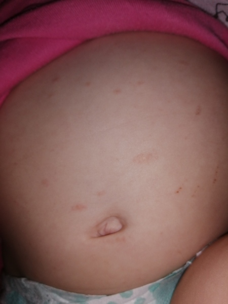 What is this rash??? 😩😩