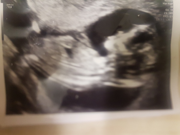 The Graduates of TTC after pregnancy loss thread#5 - 🐧 The Penguin Huddle 🐧