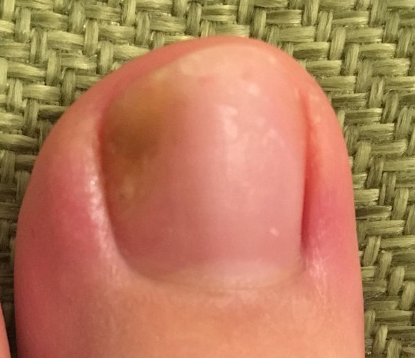 To ask you what's wrong with my nail PHOTO