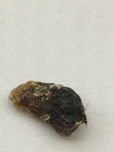 Wtaf has just come out of my ear?