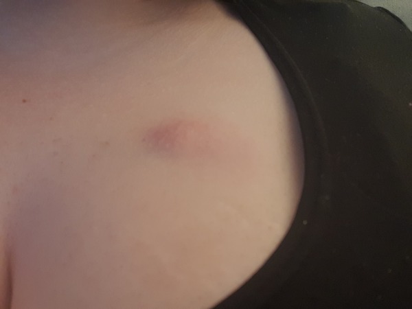 What is this and should I be worried?