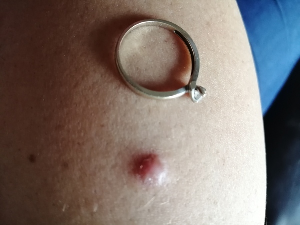 Does anyone know what this lump is? (Photo included)