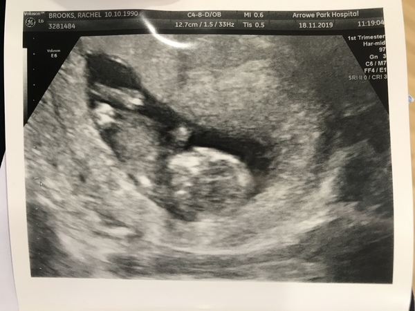 Due May 2020 (thread 3)