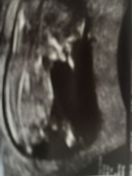 Due May 2020 (thread 3)