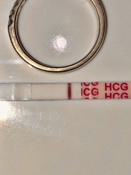 Funny Dye Splodge or Something Else?