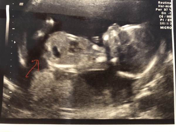 16 weeks , is it a ?!? Thoughts!