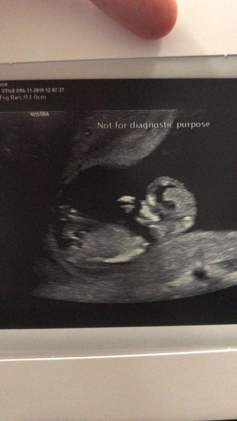 Can anyone see a nub? 12 +2 scan!