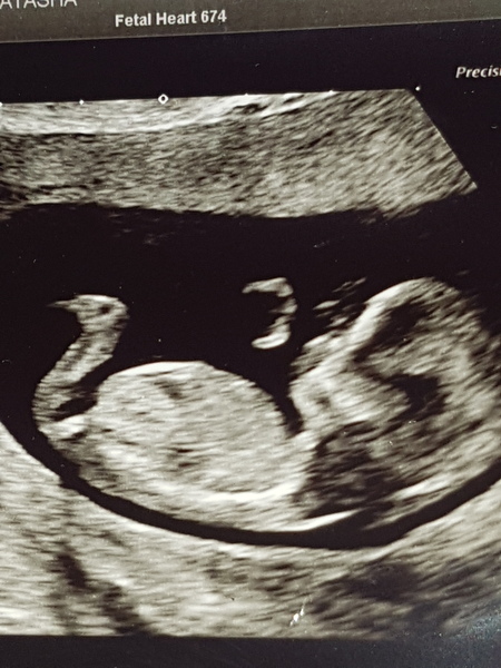 Due May 2020 (thread 3)