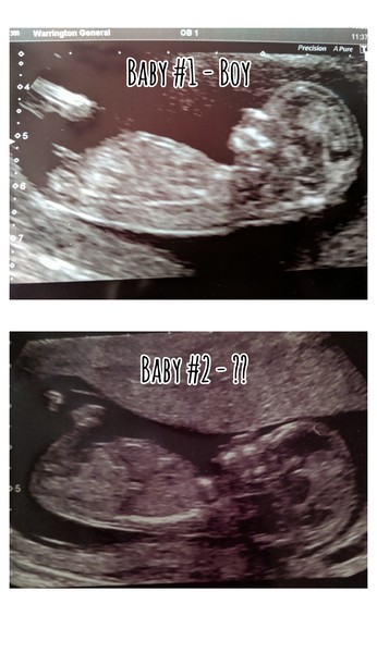 Boy/girl guesses?