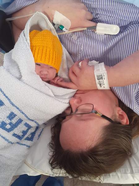 Small head/enlarged ventricles at 20 week anomaly scan - PLEASE READ