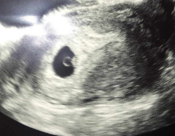 Anyone due July 2020