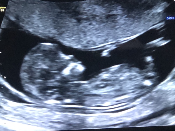 Due May 2020 (thread 3)