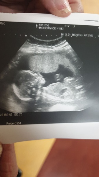 April 2020 Babies - Thread 2!