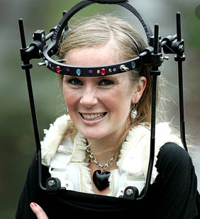 Anyones child wear a headbrace?