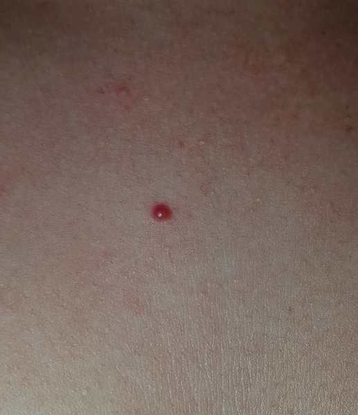 What is this? Should I see a doctor?