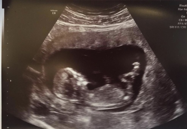 Due May 2020 (Thread 4)