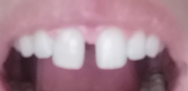 What would you do about this gap ?