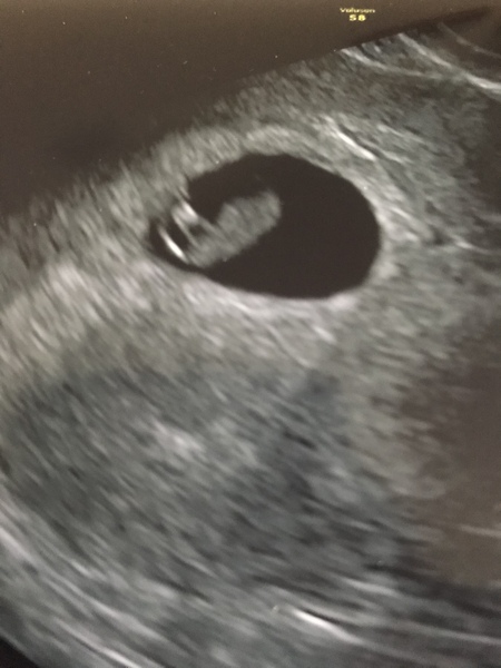 Due end of June/start of July 2020