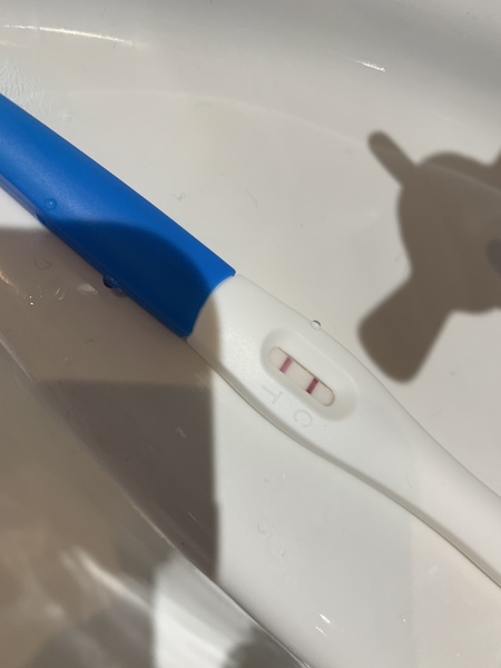 Ongoing pregnancy after abortion